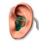 History of the Hearing Aid